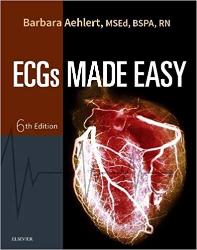 ECGs made easy