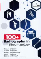 100+ Radiographs in rheumatology 