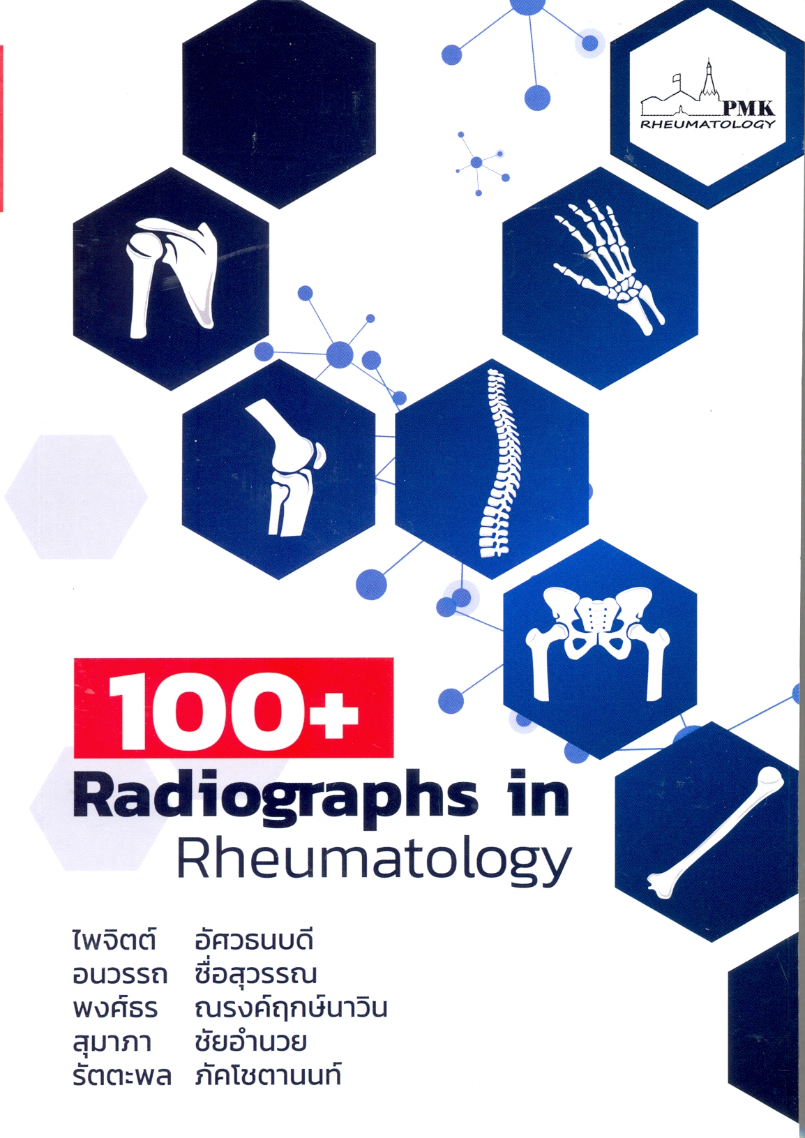 100+ Radiographs in rheumatology
